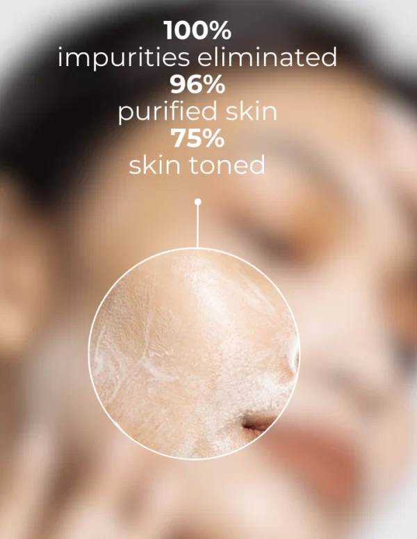 derm eden espuma limpiadora beneficios